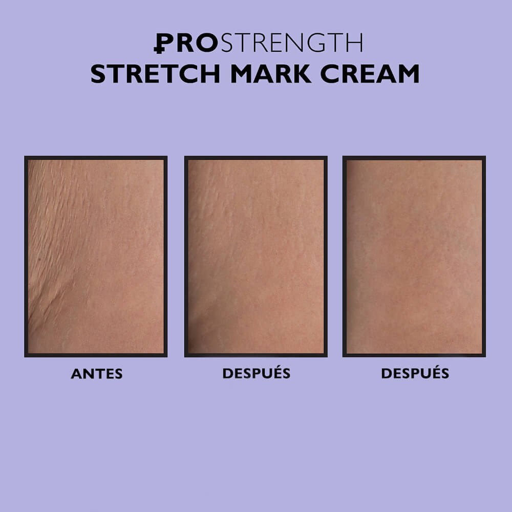 PRO STRENGTH STRETCH MARK CREAM (CREMA PARA ESTR&Iacute;AS)