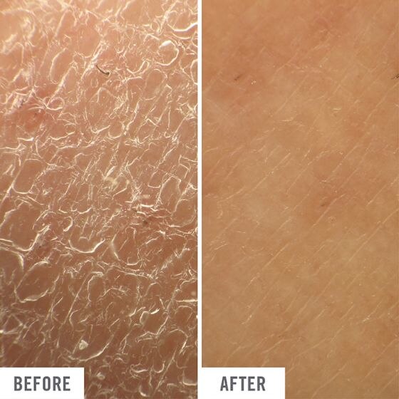 ULTRA REPAIR CREAM